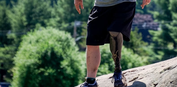 These Products Bring Comfort to People With Disabilities - Prosthetic Leg